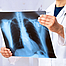 Lungenkrebs oder Lungenentzündung. Arzt-Check-up-Röntgenbild haben Problem Lungentumor des Patienten oder lange covid 19.
