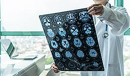 Ein Arzt betrachtet die MRI Bilder eines Gehirns.