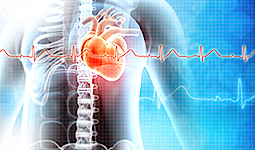 3D-Illustration einer Herzinfarktes/einer Herzrhythmusstörung