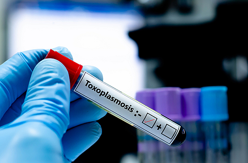 Blutröhrchen mit Toxoplamose beschriftet.