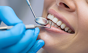 Ein Zahnarzt überprüft mit einem Spiegel und einem weiteren Instrument die Zähne einer Frau